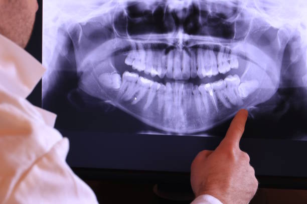 Best Teeth Whitening  in Ulysses, KS