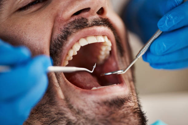 Best Emergency Tooth Extraction  in Ulysses, KS